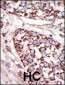 MAPK3 Antibody (N-term)